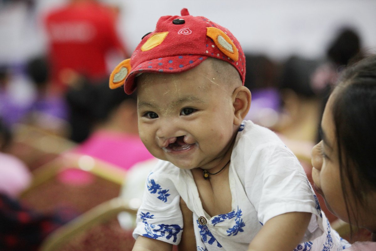 Hope everyone is settling well in 2024! Kickstart the year by helping us spread smiles to children who need a life-changing surgery. 🩷

Donate now at smileasia.org/donate 

#medicalvolunteers #nonmedicalvolunteers #cleftstrong #medicalmissions