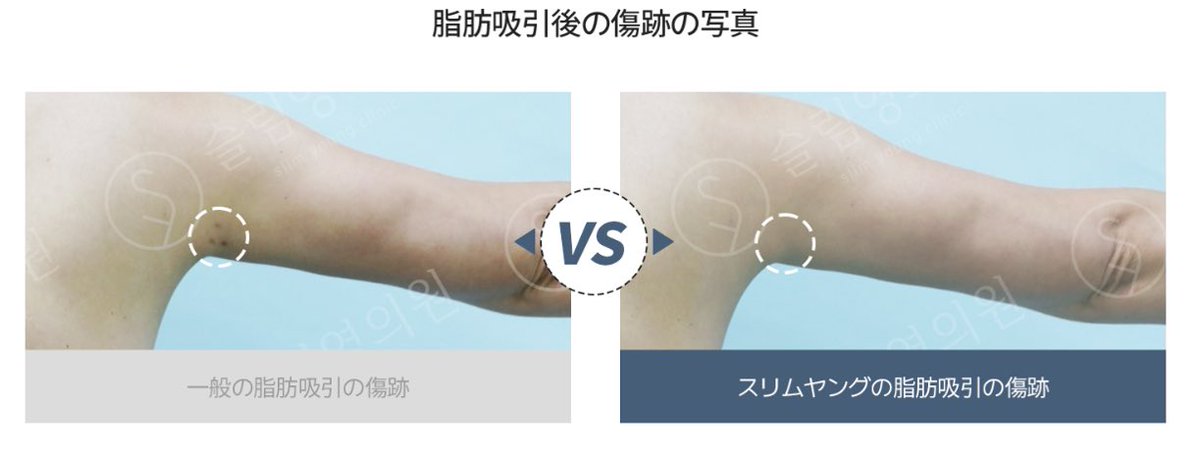 みなみ tweet media