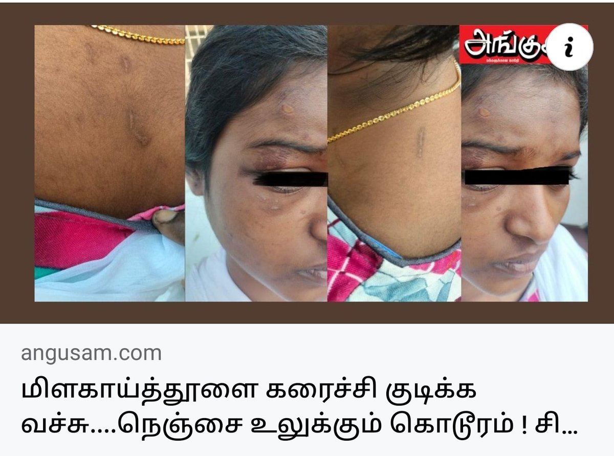 Dr.Aravind Raja tweet media