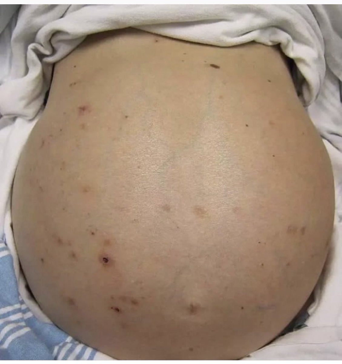 DrMedica_13's tweet image. Clinical Scenario✨
.
What are the #positive_findings in this picture? 

What are the #differentials?