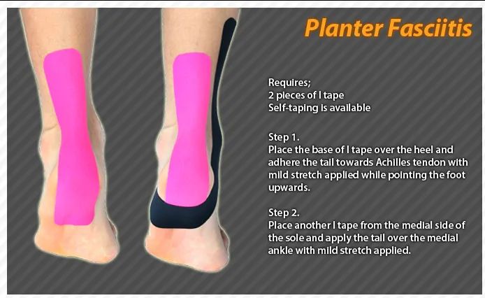 drrizwanphysio's tweet photo. Kinesiology tape is one treatment that your physical therapist may use to help provide relief from your plantar fasciitis. The main goals of using kinesiology tape for plantar fasciitis include:

Decrease pain
Take the pressure off of your plantar fascia https://t.co/FHcypjMhl3