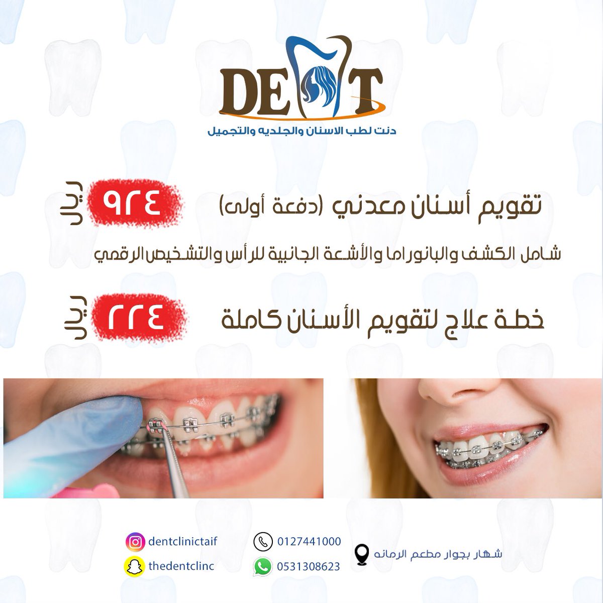 dentclinic2016's tweet photo. عروض قسم الاسنان.. https://t.co/UBARLL95Vz