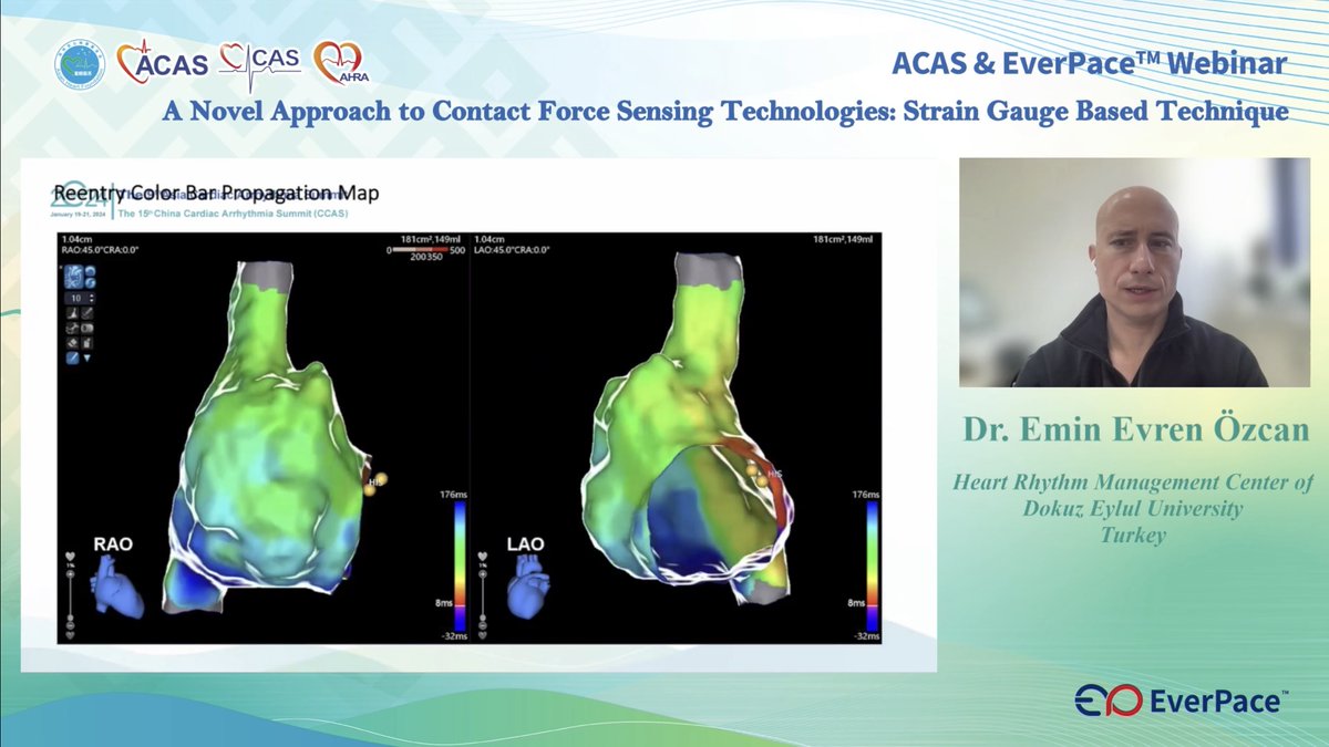 Microport EP (@microportep) on Twitter photo Thank you Dr. <a href="/can_yontar/">đđđ§ đđ¨đ§đđđŤ</a> and Dr. Emin for joining us on this excellent ACAS webinar of TrueForce clinical applications. We will continue to work relentlessly to provide innovative EP solutions in 2024. Thank you Dr. <a href="/can_yontar/">đđđ§ đđ¨đ§đđđŤ</a> and Dr. Emin for joining us on this excellent ACAS webinar of TrueForce clinical applications. We will continue to work relentlessly to provide innovative EP solutions in 2024.
