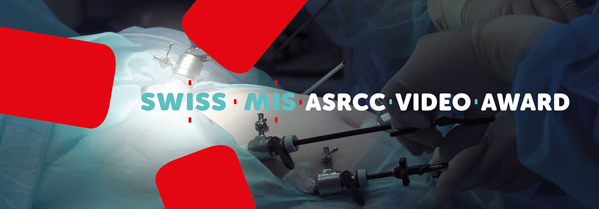 👉 REGISTER NOW to SUBMIT YOUR VIDEOS to the 21st TRIPARTITE MEETING (Dreiländertreffen) for Minimally Invasive Surgery taking place on 7th – 8th March 2024 in Basel! 👈 
🏆 1st Prize : 1'000 CHF; 2nd Prize : 300 CHF, 3rd Prize: 150 CHF. 
More information: swiss-mis.ch/21st-tripartit…