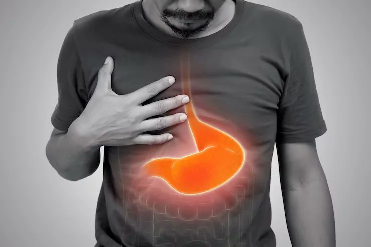 RahaAyurveda's tweet photo. The Most Effective Ayurvedic Remedies for Acidity Relief
https://t.co/s5O1LesQMs
#hyperacidity #rahaayurveda #acidity #stomachpain #ayurvedatreatment https://t.co/DeFOkVbl8W