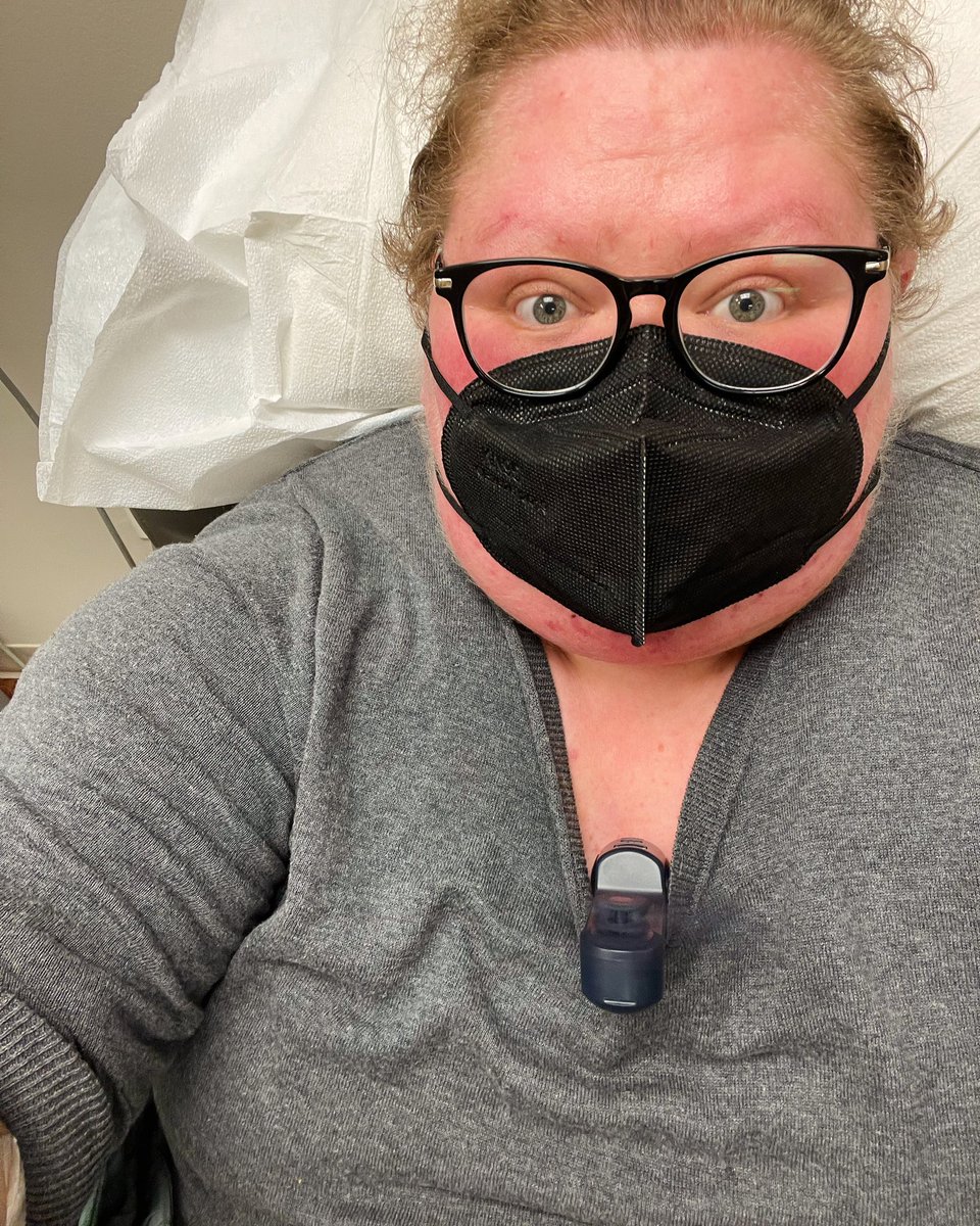 CaneAndCanines's tweet photo. Sticking my fan in the neck of my sweater for hands-free hot-face-cooling while I get my infusion? Innovation. https://t.co/zQzZadYeoP