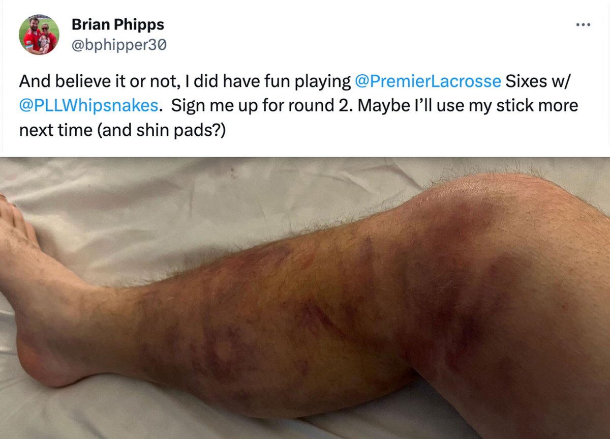 Premier Lacrosse League (@premierlacrosse) on Twitter photo What 4️⃣5️⃣+ shots PER GAME looks like… 🫣👇
Goalies are a different breed.
P.S. How’s retirement, <a href="/bphipper30/">Brian Phipps</a>?? What 4️⃣5️⃣+ shots PER GAME looks like… 🫣👇
Goalies are a different breed.
P.S. How’s retirement, <a href="/bphipper30/">Brian Phipps</a>??