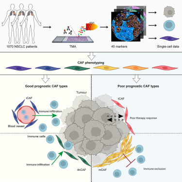 Online Now: Cancer-associated fibroblast phenotypes are associated with patient outcome in non-small cell lung cancer dlvr.it/T1bxBL
