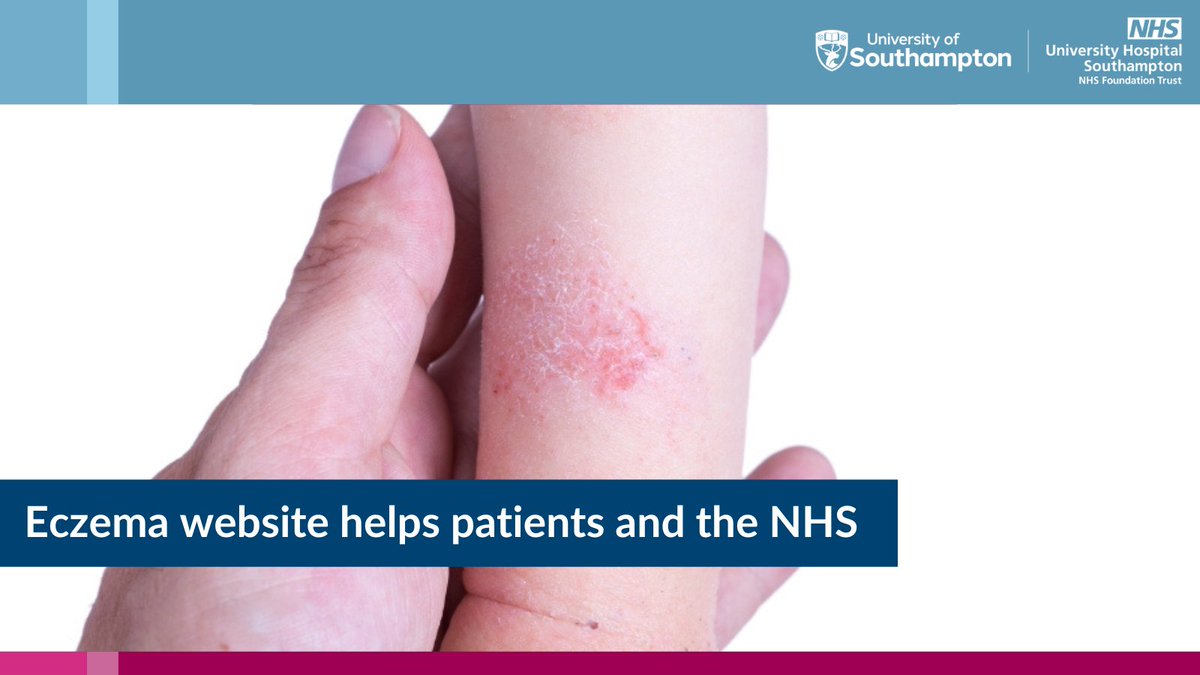 Health Research | Southampton (@uhsftresearch) on Twitter photo Eczema impacts quality of life and adds significant costs for the <a href="/NHSuk/">NHS</a>.
New research, co-led by <a href="/MiriamSanter/">Miriam Santer</a>, shows the <a href="/ECO_eczema/">Eczema Care Online</a> website could provide big savings while also improving #eczema care. π
research.uhs.nhs.uk/news/eczema-we⦠Eczema impacts quality of life and adds significant costs for the <a href="/NHSuk/">NHS</a>.
New research, co-led by <a href="/MiriamSanter/">Miriam Santer</a>, shows the <a href="/ECO_eczema/">Eczema Care Online</a> website could provide big savings while also improving #eczema care. π
research.uhs.nhs.uk/news/eczema-weβ¦