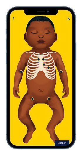 uob_midwifery's tweet photo. Students studying Systematic examination of the newborn at UoB now have access to this amazing app through the university- don’t miss out! 
https://t.co/eKvdyCbBkN
#midwifery #nipe #cambridgehealth #teambradford https://t.co/z9OZc3l1Ht