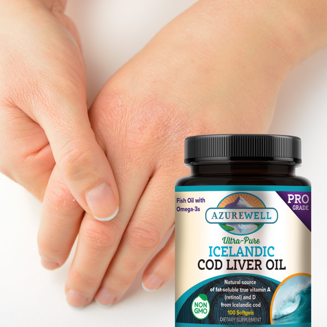 AzureLivingWell's tweet image. Chilly #winter air can be harsh, leaving skin dry &amp;amp; itchy. Layer up against the cold from the inside out. Icelandic #codliveroil is abundant in omega-3 fatty acids. Help preserve your skin's moisture &amp;amp; elasticity all winter long. Save 10% this month.
azurestandard.com/shop/product/n…