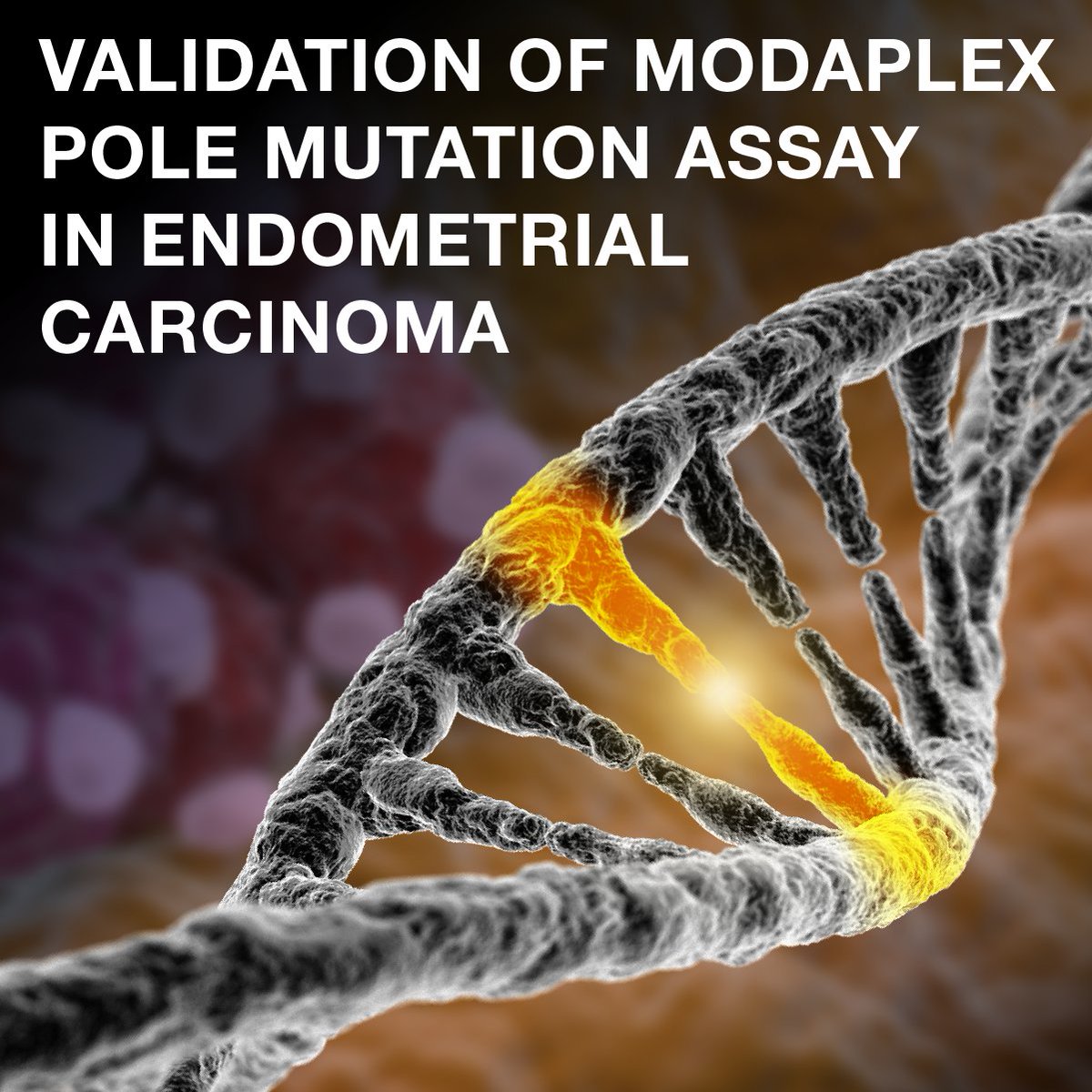 BiotypeDx's tweet photo. The first ever scientific publication of our MODAPLEX POLE/POLD1 Mutation Analysis Kit has been published! In early 2023 the publication was presented as a poster during that year’s ESMO congress and has now been accepted by a journal:

https://t.co/N41zZw1QWz

#MODAPLEX #Cancer https://t.co/cyjEQNAttx