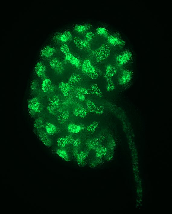Flashback #FluorescenceFriday to an image I took years ago of an embryonic kidney from a TCF/Lef:H2B-GFP transgenic mouse highlighting active Wnt signaling