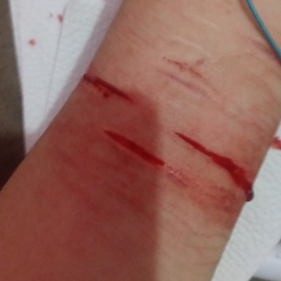 -_-