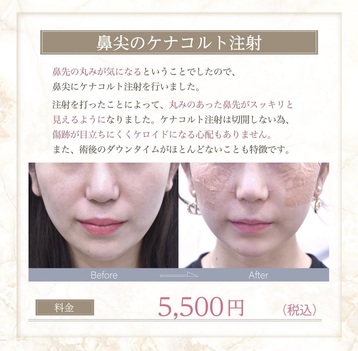 みなみ tweet media