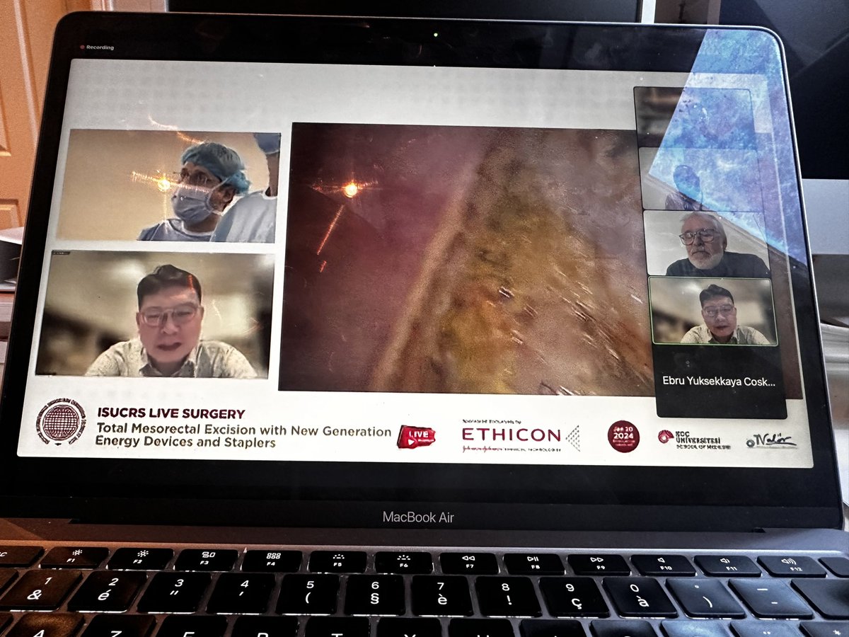 Joep Knol MD, PhD (@knoljoep) on Twitter photo Live TME from Istanbul for <a href="/ISUCRS1/">ISUCRS</a> <a href="/JNJInnovation/">Johnson & Johnson Innovation</a> <a href="/JosephNunooMen1/">Joseph Nunoo-Mensah</a> for free!
Join us!
isucrs.org/events/isucrs-… Live TME from Istanbul for <a href="/ISUCRS1/">ISUCRS</a> <a href="/JNJInnovation/">Johnson & Johnson Innovation</a> <a href="/JosephNunooMen1/">Joseph Nunoo-Mensah</a> for free!
Join us!
isucrs.org/events/isucrs-…