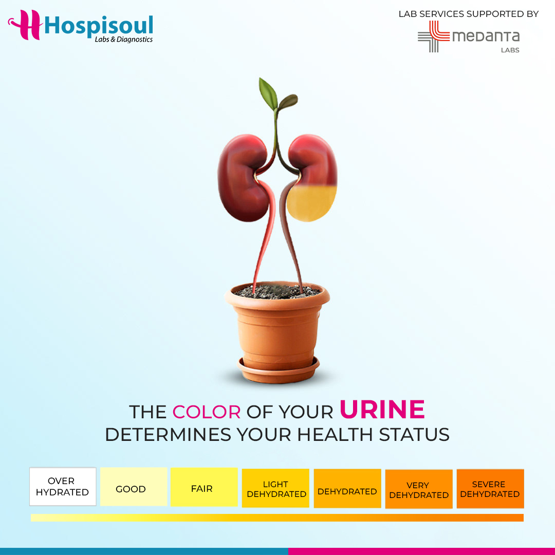 hsldiagnostics's tweet photo. Unlocking the secrets to a healthier you! 📷 Embrace kidney fitness with these simple tips: hydrate, eat nutrient-rich foods, and prioritize regular exercise. Your kidneys will thank you!

#KidneyHealth #WellnessJourney #hospisoul #Kidneydisease #medantalabs #weworkmediaventures https://t.co/g8rdgyWEms