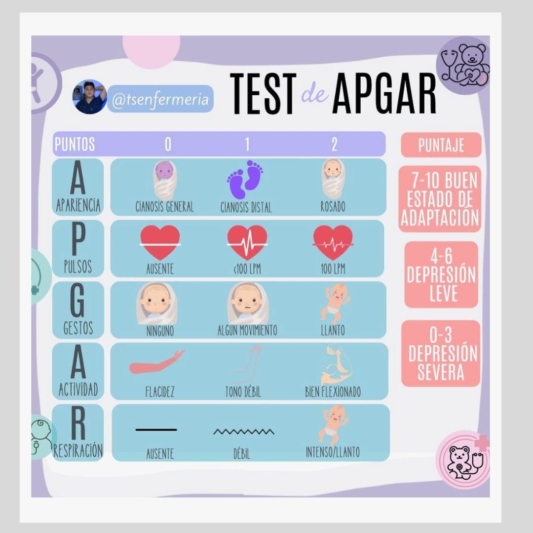 El #testdeApgar es una evaluación rápida del estado de salud de un #reciénnacido. Se realiza a los 1 y 5 minutos después del nacimiento, calificando aspectos como frecuencia cardíaca, esfuerzo respiratorio, tono muscular, reflejos y color de la piel.
.
Infografía #tsenfermeria