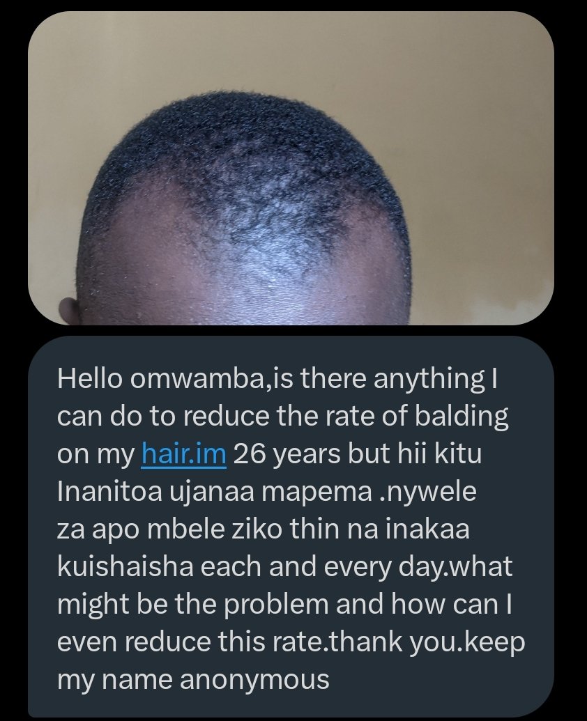 omwambaKE's tweet photo. How can this legend reduce the rate of balding on his head? https://t.co/HxuoKwIWpj