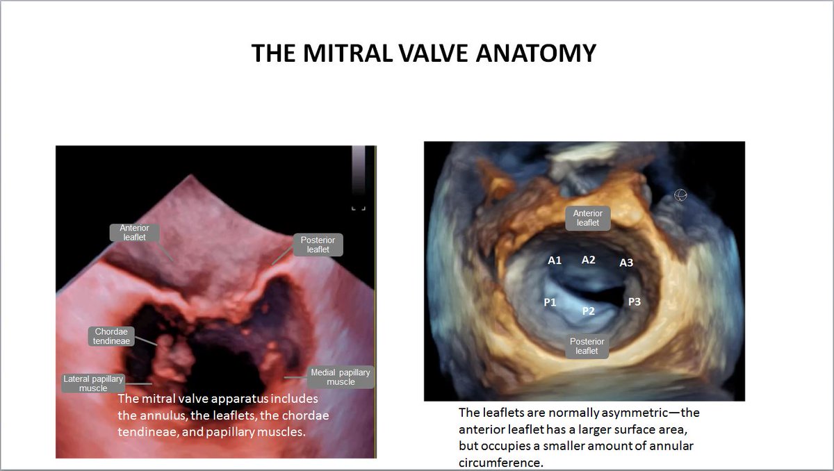echo_stepbystep's tweet photo. #3DEchoBerlin Tips and Tricks on screening and Guiding of TEER 🗣️ @papadocardio 🇬🇷
3D #echofirst in Heart Failure and Valvular Disease #VHD by @NMerke &amp; @dhzcharite 
@JGrapsa @VDelgadoGarcia @EchoBielefeld @hahn_rt
@fiore_corrado @denisamuraru @lpbadano
@alexsfelixecho https://t.co/ALXQUkPs2g