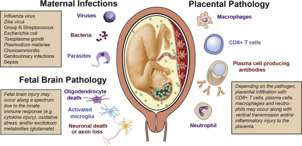 AJOG Expert Review: The fetal origins of mental illness ow.ly/pkoS50CQnoN