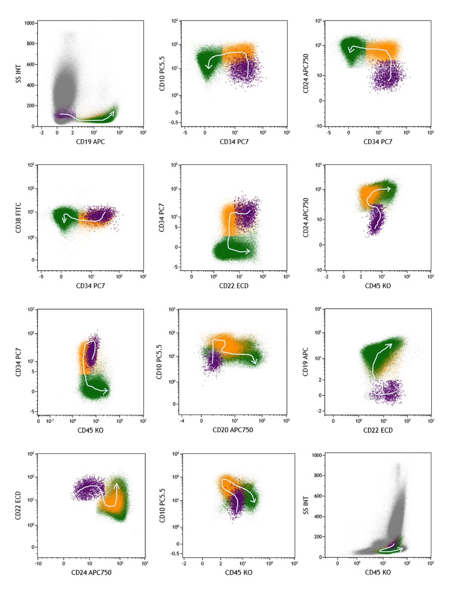 Thulasi Raman (@thulas31081987) on Twitter photo Happy to share our paper which has just published in clinical cytometry on Stage 0 Hematogones.
onlinelibrary.wiley.com/doi/10.1002/cy…
<a href="/DrArunCMC/">Arun Kumar Arunachalam</a> <a href="/drdatari/">Phaneendra Datari</a> <a href="/drkunalsehgal/">Kunal Sehgal</a> <a href="/DrAnilHandoo/">Dr Anil Handoo</a> <a href="/ananthvikas/">ananthvikas</a> <a href="/KBommannan/">Karthik Bommannan</a> <a href="/PrashantTembha1/">Prashant Tembhare</a> <a href="/Jasmita_Dass/">Jasmita</a> <a href="/Anu_8338/">Anu</a> <a href="/LakshmiKoulmane/">Sindhura Lakshmi</a> <a href="/DeepakM67014511/">Deepak M B</a> Happy to share our paper which has just published in clinical cytometry on Stage 0 Hematogones.
onlinelibrary.wiley.com/doi/10.1002/cy…
<a href="/DrArunCMC/">Arun Kumar Arunachalam</a> <a href="/drdatari/">Phaneendra Datari</a> <a href="/drkunalsehgal/">Kunal Sehgal</a> <a href="/DrAnilHandoo/">Dr Anil Handoo</a> <a href="/ananthvikas/">ananthvikas</a> <a href="/KBommannan/">Karthik Bommannan</a> <a href="/PrashantTembha1/">Prashant Tembhare</a> <a href="/Jasmita_Dass/">Jasmita</a> <a href="/Anu_8338/">Anu</a> <a href="/LakshmiKoulmane/">Sindhura Lakshmi</a> <a href="/DeepakM67014511/">Deepak M B</a>