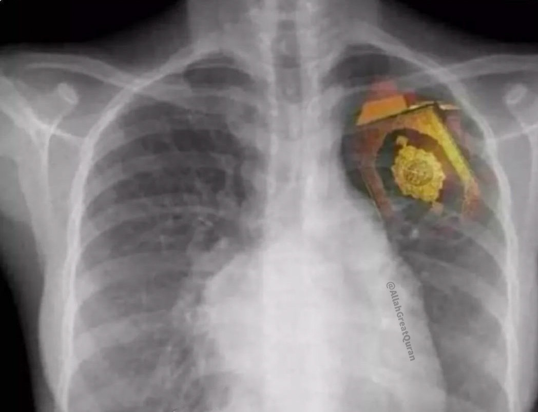 May Allah enlighten our hearts with the light of the Holy Quran.