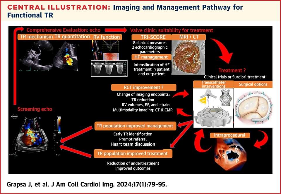 Keep up to date on #TricuspidRegurgitation in this #JACCIMG state-of-the-art review: bit.ly/3U6e8dS

#cvVHD #vhdTR #echofirst #cardiology #CardioTwitter #cardioEd