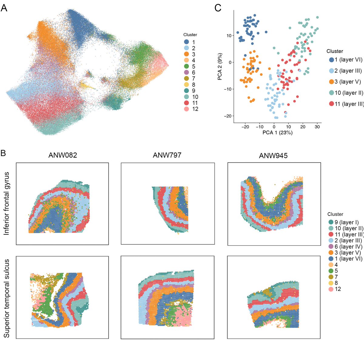 sha_zhiqiang's tweet photo. We used BayesSpace to perform a data-driven analysis based on gene expression profiles, identifying layer-like clustering in cerebral
cortical tissue samples. @edward130603 @raphg, thanks for developing such an amazing approach. https://t.co/tRmYVbbbVi