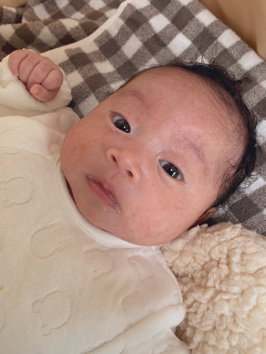 N115J's tweet photo. おでこは確実は私似🫡 https://t.co/Ih7u4nllLC