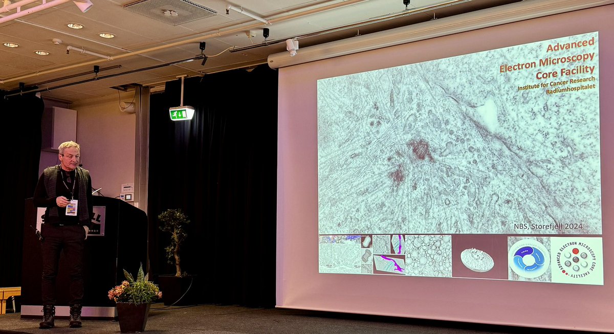 OSLOmicsCore's tweet image. Great presentations of the ICR @flowcytometri and electron microscopy core facilities at @NbsOslo annual meeting. @IcrCore @OusResearch. How technology and competence can excel your research.
