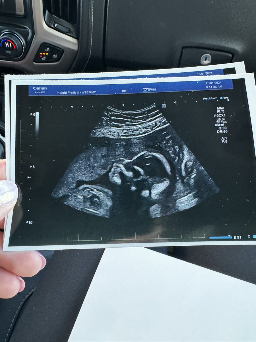 Yup, that’s a baby