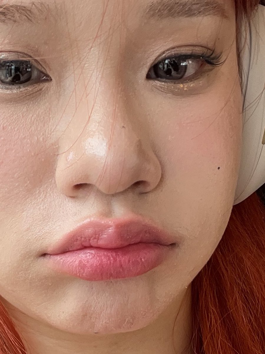 FKYz_'s tweet photo. อย่างนี่ใช้คุชชั่น espoir ตลับแดง ด้วยความเนื้อมันแมทมากเลยแห้ง ละช่วงนั้นนี่ทำหน้าเลเซอร์ต่างๆหน้ามันจะแห้ง ละนี่แต่งหน้าบนเครื่องบินอีกความแห้งคูณ 10 ลอกเป็นขุยเลยดูในรูปได้ พอถึงโรงแรมล้างหน้า มาส์กหน้าก่อนแต่งหน้า เดินฮ่องกงฉ่ำหน้าผิวยังสวยเหมียนเดิม เราว่าของบางอย่างมันไม่ใช่ไม่ดีนะ มันก็ขึ้นอยู่กะสภาพผิว ขึ้นอยู่กะการใช้ด้วยอ่ะ เก็ตม่ะ