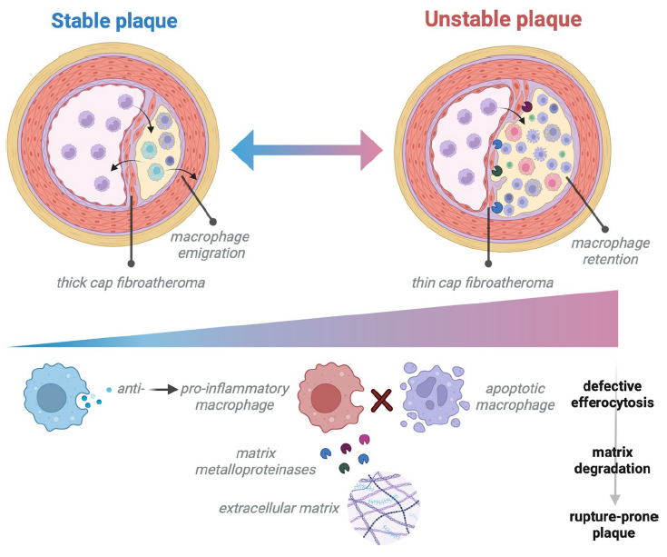 Macrophages in atherosclerotic plaque stability and rupture. link.springer.com/article/10.100…