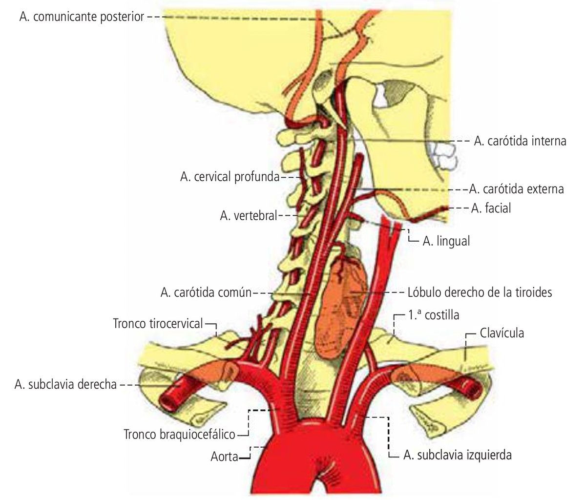 Las arterias carótidas internas son ramas de bifurcación de las arterias  carótidas comunes que se originan: la derecha en el tronco braquiocefálico  y la izquierda en el arco aórtico. #ENARM #ENARM2024, image size:1200x1024