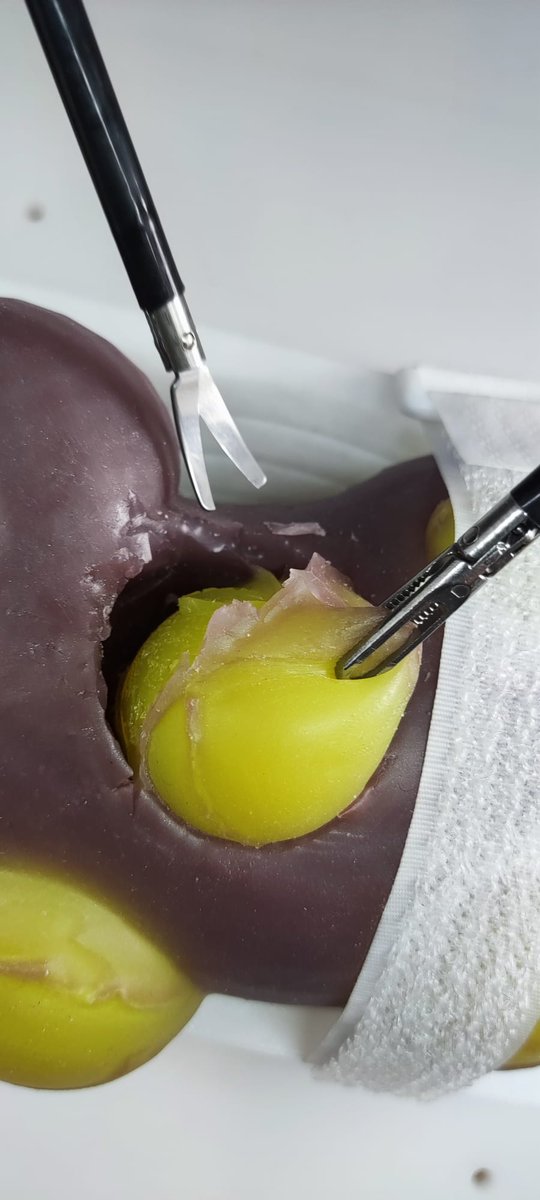 Urology3D's tweet photo. Shop available now!
Excited to launch our first training model for #Partialnephrectomy!
It's an affordable solution for laparoscopic & robotic surgery training. Check it out at:
https://t.co/yjOComtNG2
#SurgicalTraining #TrainingForEveryone https://t.co/w380z8BHHo