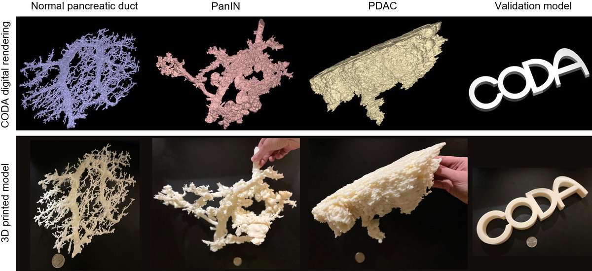 Read about how we use CODA to 3D print pancreas microanatomy from serial histological sections, out today in Advanced Materials Technologies.

Big thanks to the Johns Hopkins WSE manufacturing team who helped us with the printing 🤗

onlinelibrary.wiley.com/doi/epdf/10.10…