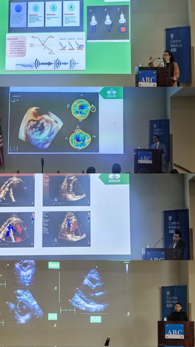 Tomas_MA_Cardio's tweet photo. 8va cumbre Interinstitucional de Casos Clínicos @SONECOM_AC. Porque siempre es mejor aprender viendo casos clínicos. @VazyurVasquez @EduardoVR03 @MenciaD_Cardio @MDBeni @CyntiaMachain @ANCAM_MEXICO @smexcardiologia https://t.co/cJxsOddQgt