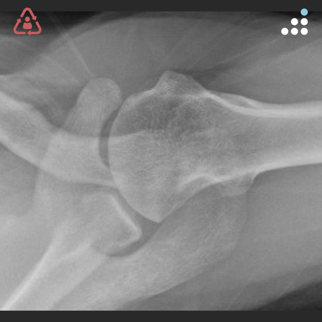 Orthobullets tweet media