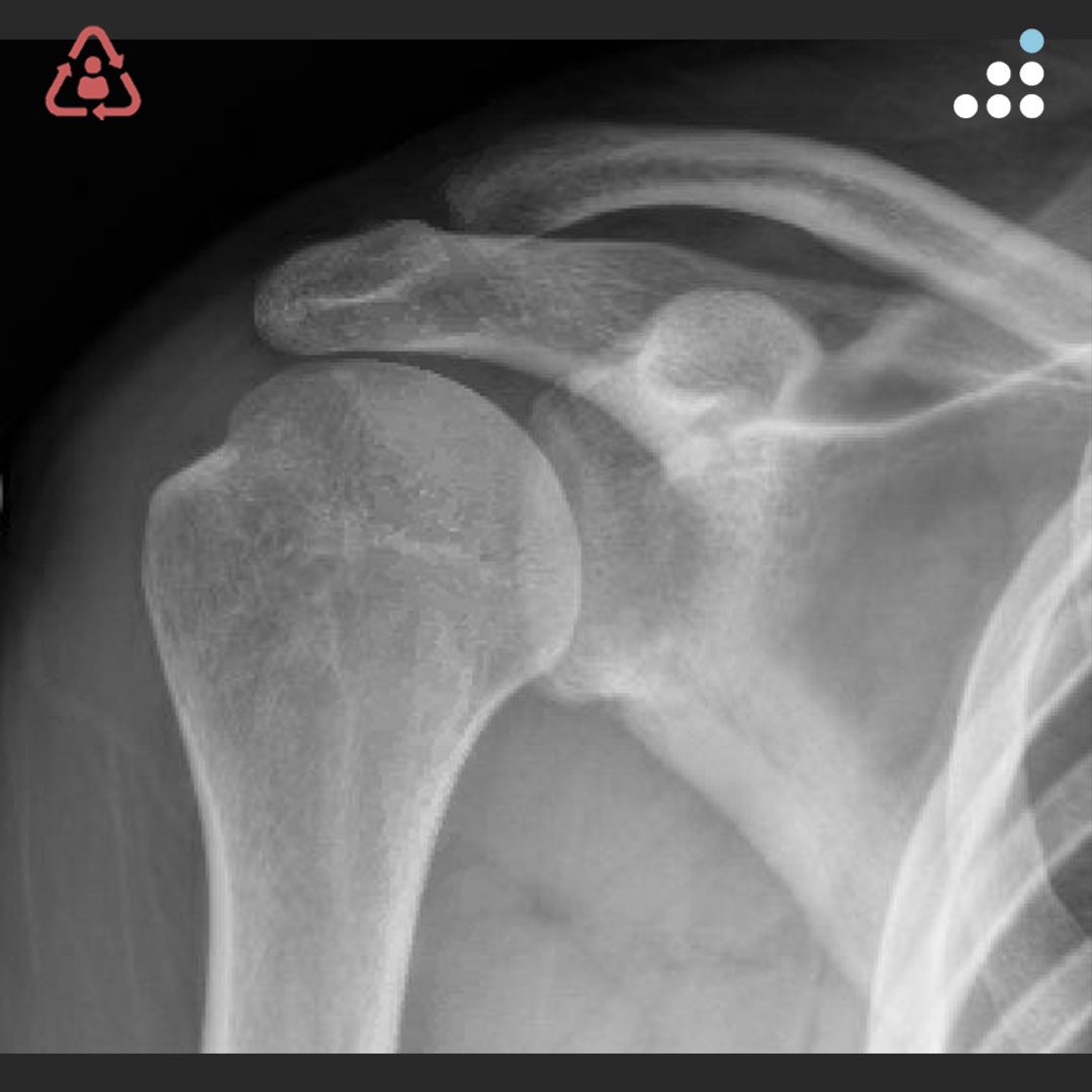 Orthobullets tweet media