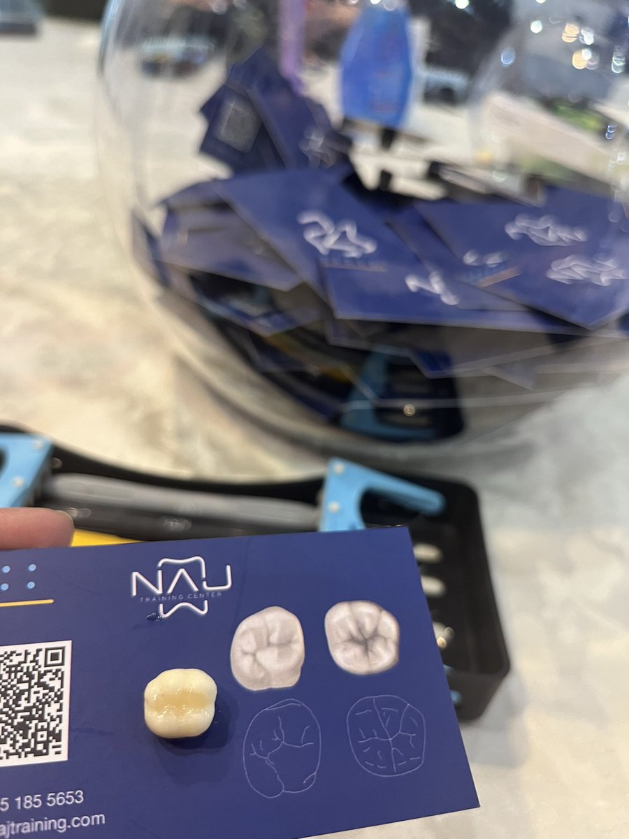 hadee6l's tweet photo. Class I composite restoration 
The most awaited competition every year🤩
@alajaji_norah 
@najtraining 
#SIDC2024 https://t.co/3HkOcBwRCC