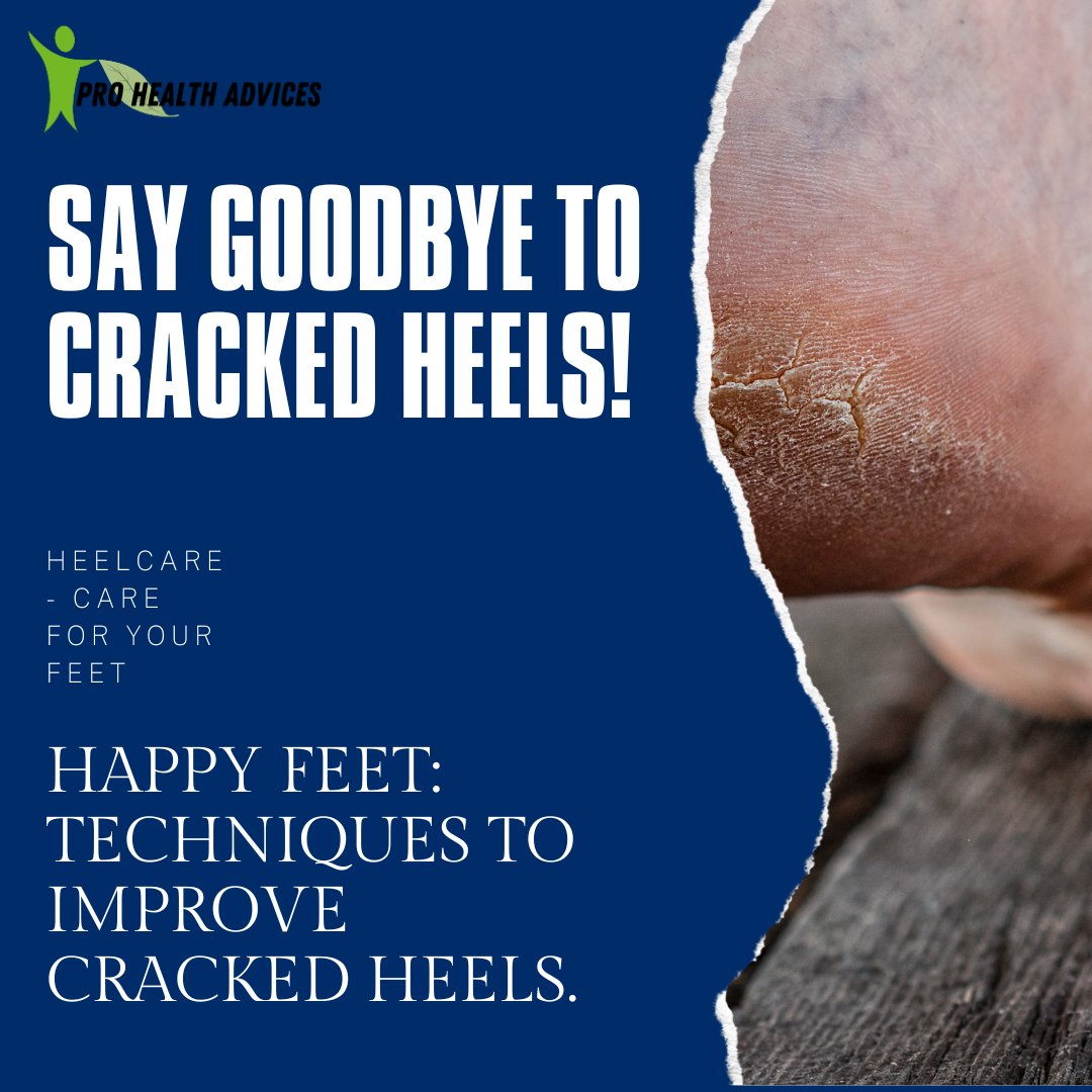 PHadvices's tweet photo. Read More: https://t.co/tiDX660WYA
Visit Us: https://t.co/7Op4jHeYwV
Contact us: prohealthadvices@gmail.com
Follow Us On Instagram: @prohealthadvices

#crackedheelhacks #footlover #summersandalready #naturalskincare #diybeauty #smoothheels #hydratedfeet #comfyshoes #selfcare https://t.co/Ec6yjelKNC