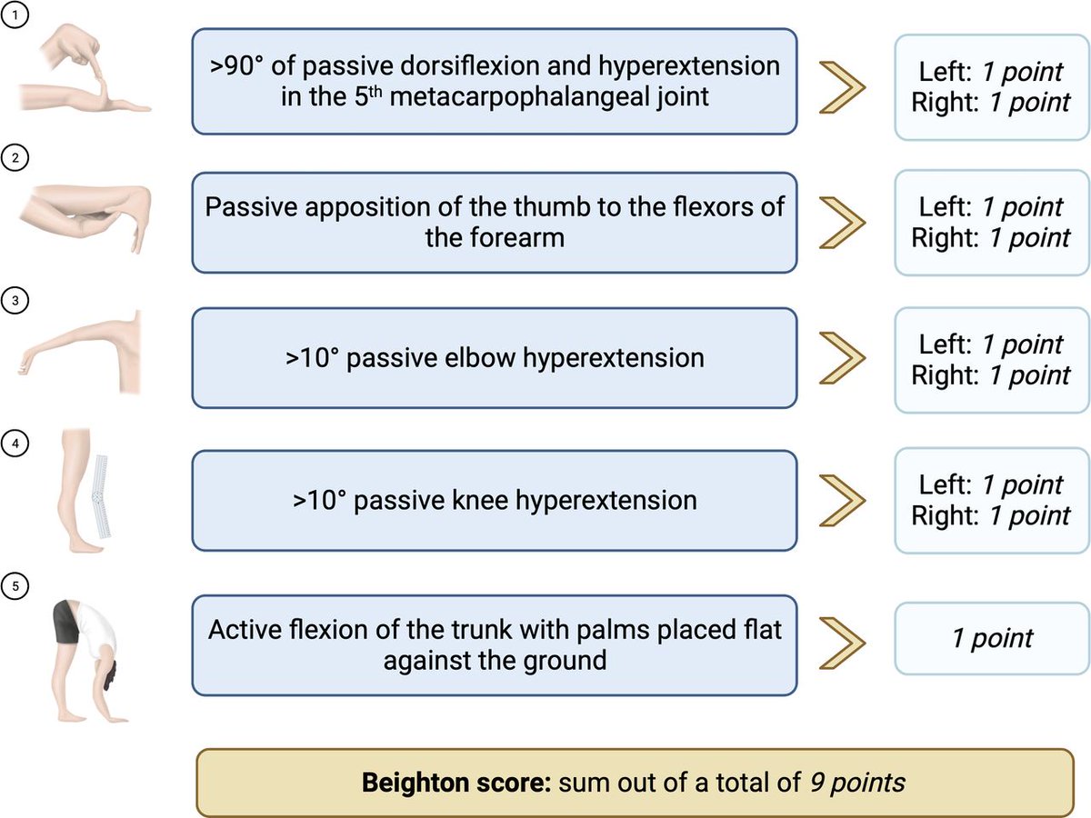 📣 The days of generalised joint hypermobility assessment in all patients with ACL injury are here ✅

1️⃣ Identifies contributing factors to second ACL injury after ACL-R
2️⃣ Help to decide on graft choices
3️⃣ Aid optimal rehabilitation protocols 

👉 bit.ly/48CuVcJ