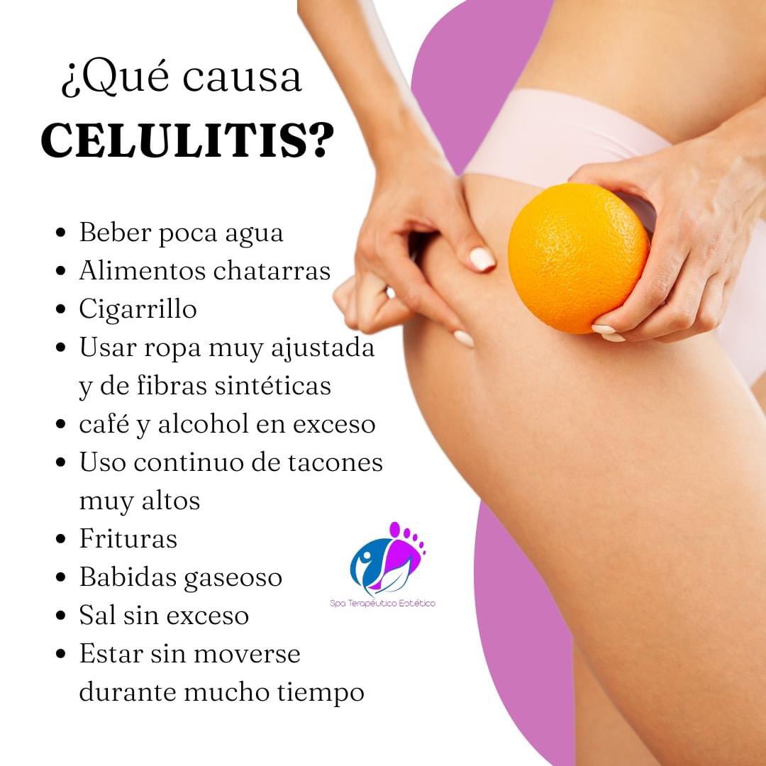 EsteticoSpa's tweet photo. La celulitis
Es una infección bacteriana común de la piel que causa enrojecimiento, inflamación y dolor en el área infectada. 
De no tratarse, puede propagarse y causar problemas de salud graves. 

#celulitis #infecciosa #piernas #salud #estetica https://t.co/ZFcCvjUqQW