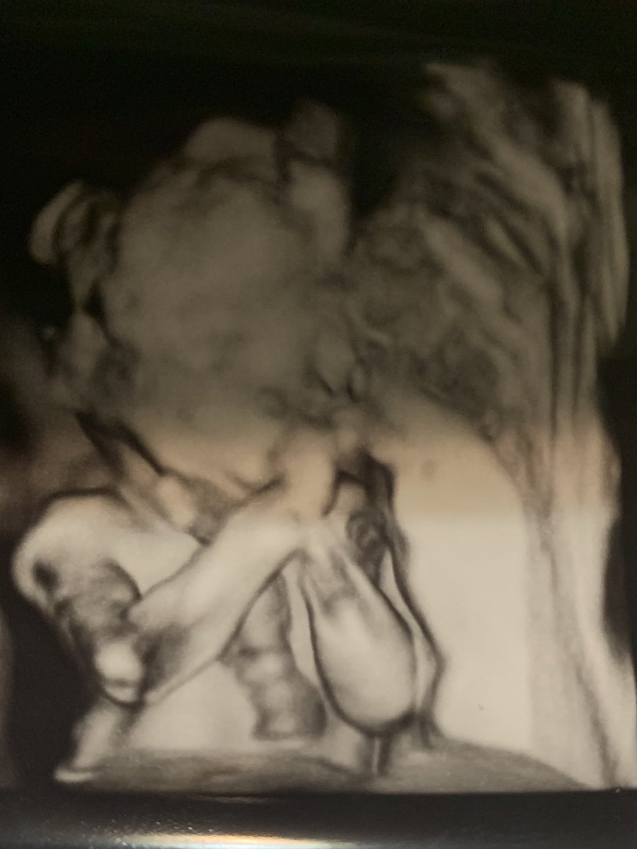 YaAuntieIsHere's tweet image. #ItsABoyπΌπ
#BabyMcCoyπ
We love you so muchπ€ My first grandson π«Άπ½π«‘