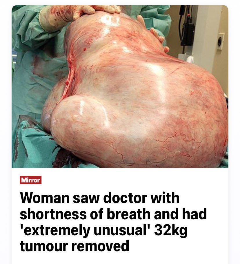 grammarmonster's tweet image. 😶 I hope they’re both okay. 

#misplacedModifiers