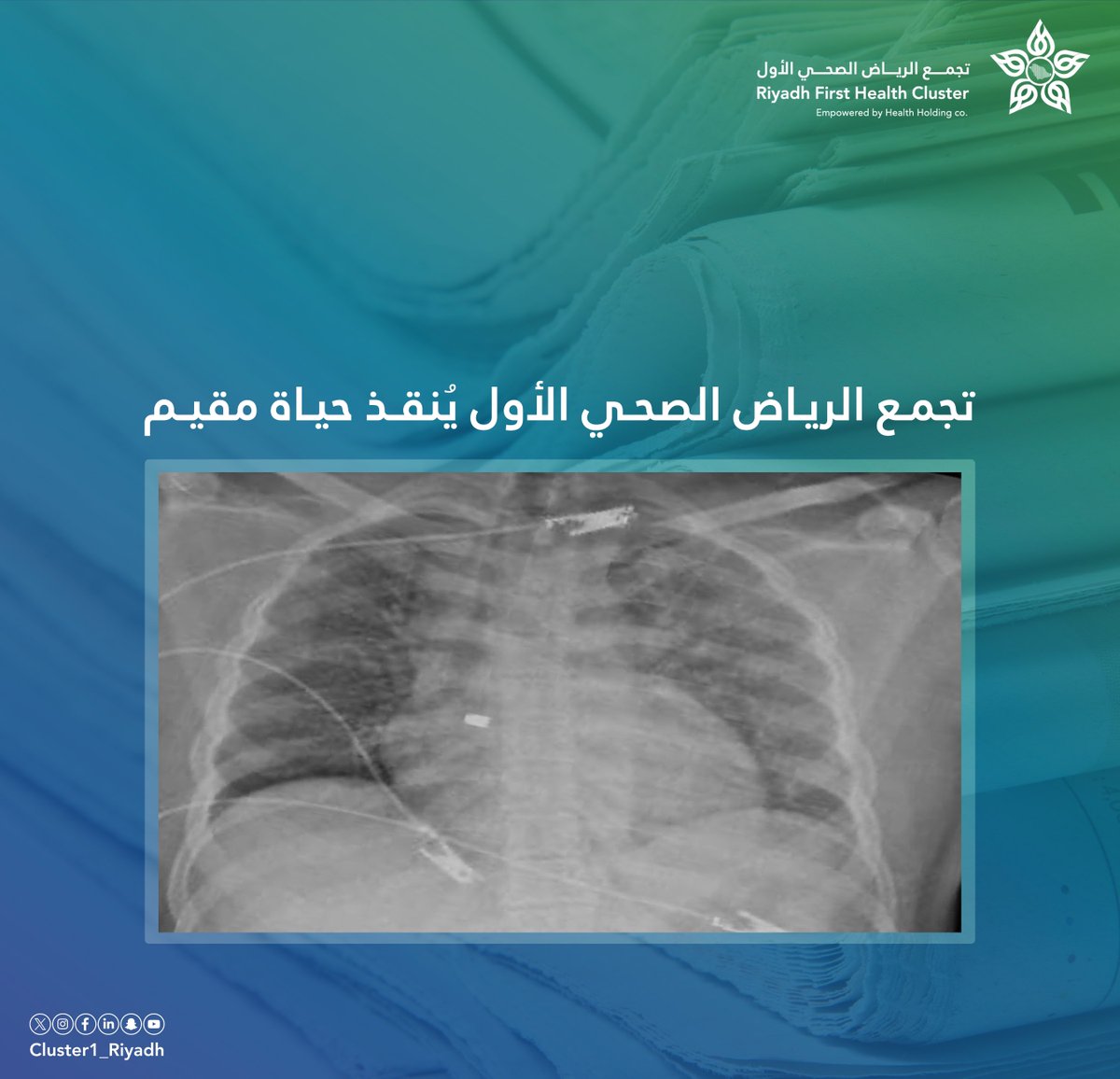 🗞️| #تجمع_الرياض_الصحي_الأول يُنقذ حياة مقيم.

alriyadh.com/2055012