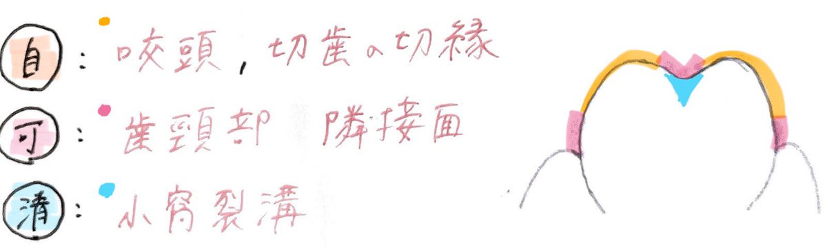 Hirschrlt（ヒルシェフェルト）

･自浄域
➡️咀嚼、発音によって自然に清掃される

･可浄域
➡️自分で清掃可能

･清掃不可部位
➡️自分では清掃不可。
     プロフェッショナルケア必要