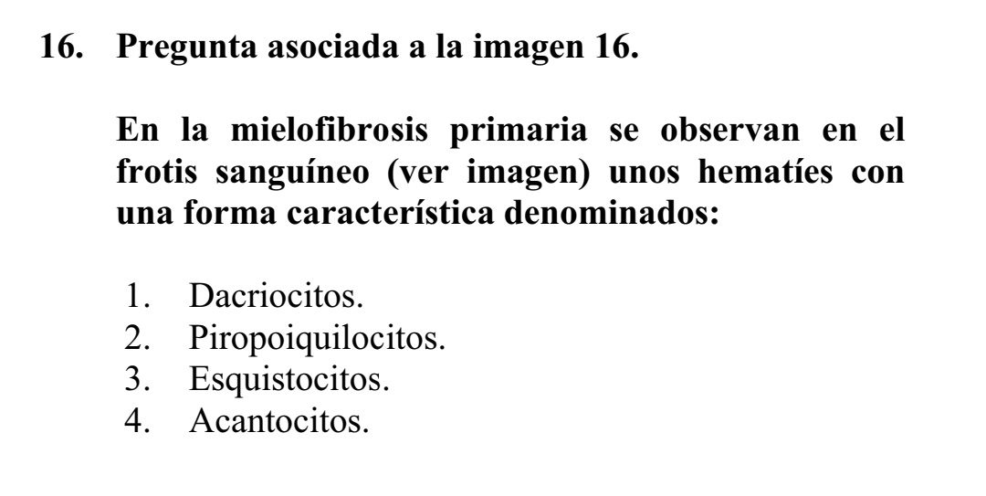 salvadorpayan's tweet image. 🔴Preguntas relacionadas con la #Eritropatología en #MIR24 👇🏾🧵

16: #Dacriocitos, esos hematíes en forma de lágrima.