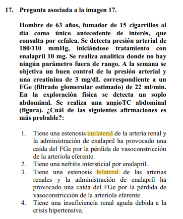 justtmar's tweet photo. Preg 17, imagen (muy fan). Pura técnica test, pero el angioTC ya muestra un riñón derecho prácticamente anulado con clara estenosis (monorreno funcional, exacto), lo que aumenta la susceptibilidad a esta situación. Mantenía el FG gracias al SRAA.
¿✅?Marcaría la opción 3. https://t.co/xfrN4AiPLT